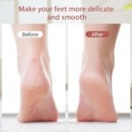 Rechargeable Electric Pedi Callous Remover - Image 3